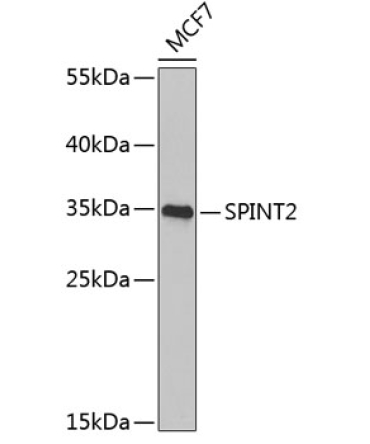 SPINT2 Rabbit Polyclonal Antibody