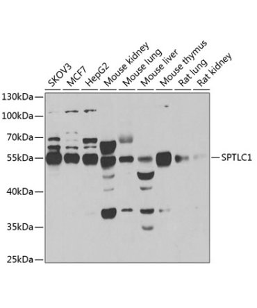 SPTLC1 Rabbit Polyclonal Antibody