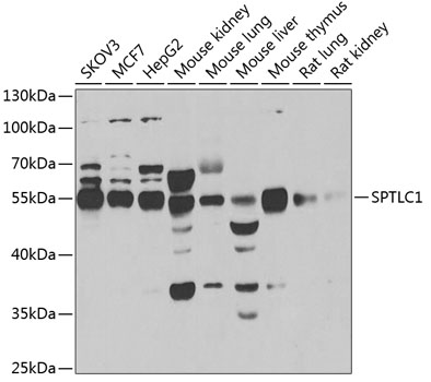SPTLC1 Rabbit Polyclonal Antibody