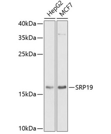 SRP19 Rabbit Polyclonal Antibody