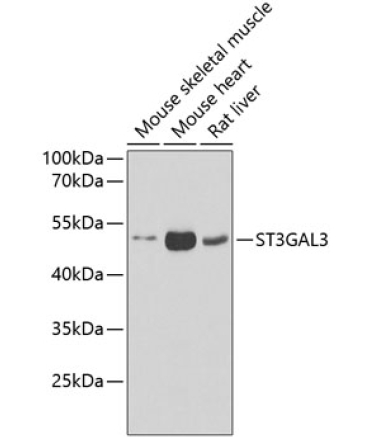 ST3GAL3 Rabbit Polyclonal Antibody