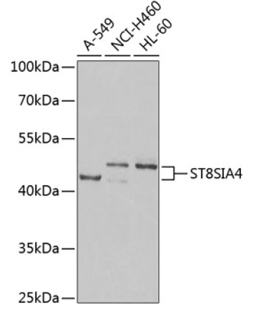 ST8SIA4 Rabbit Polyclonal Antibody