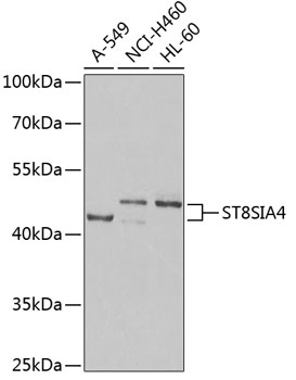ST8SIA4 Rabbit Polyclonal Antibody