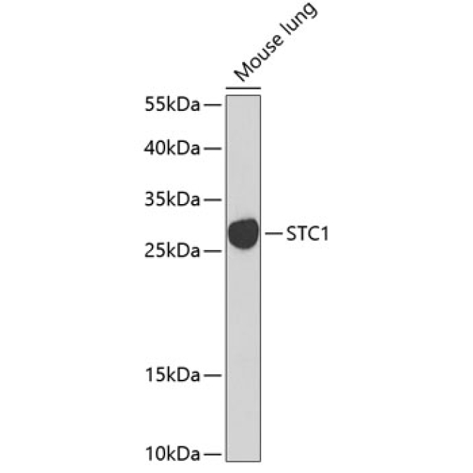 STC1 Rabbit Polyclonal Antibody