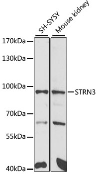 STRN3 Rabbit Polyclonal Antibody