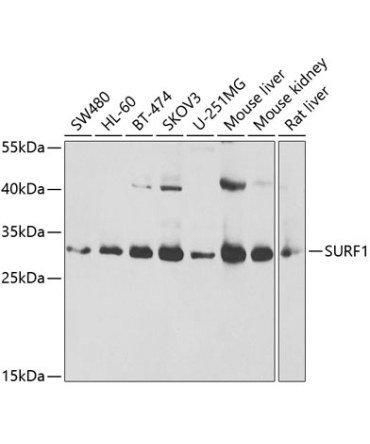 SURF1 Rabbit Polyclonal Antibody