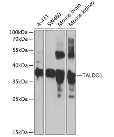 TALDO1 Rabbit Polyclonal Antibody
