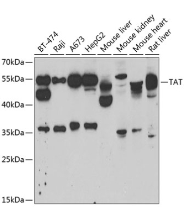 TAT Rabbit Polyclonal Antibody
