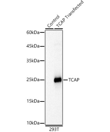 TCAP Rabbit Polyclonal Antibody