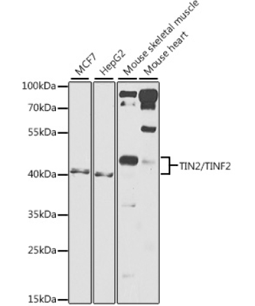 TIN2/TINF2 Rabbit Polyclonal Antibody
