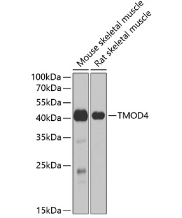 TMOD4 Rabbit Polyclonal Antibody