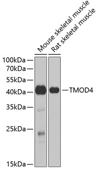 TMOD4 Rabbit Polyclonal Antibody
