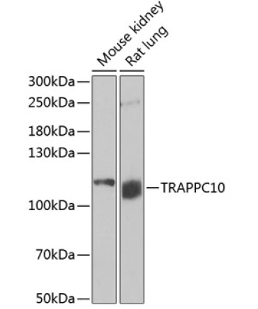 TRAPPC10 Rabbit Polyclonal Antibody