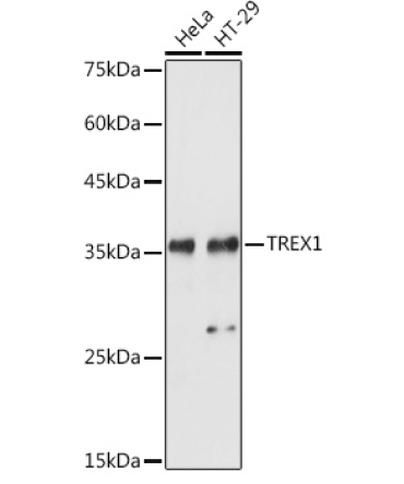TREX1 Rabbit Polyclonal Antibody