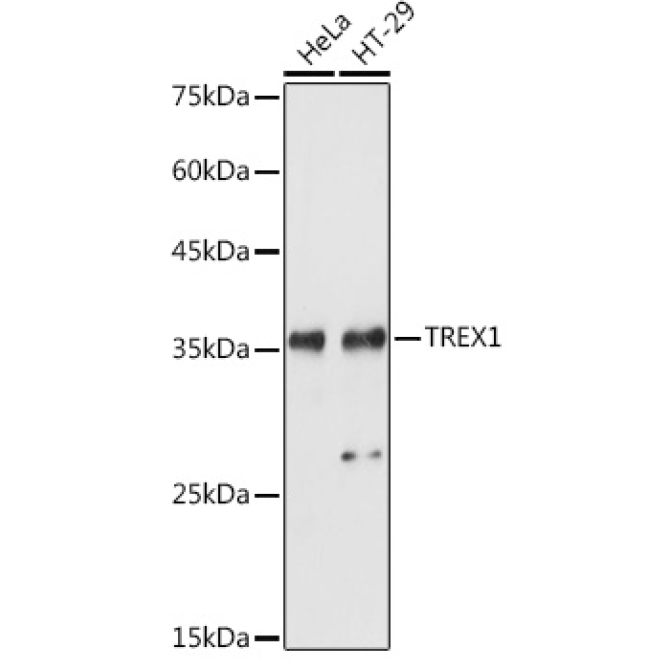TREX1 Rabbit Polyclonal Antibody