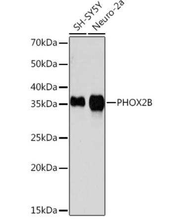 PHOX2B Rabbit Monoclonal Antibody