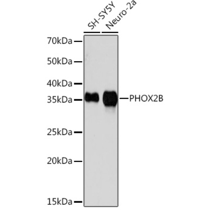 PHOX2B Rabbit Monoclonal Antibody