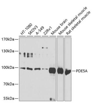 PDE5A Rabbit Polyclonal Antibody
