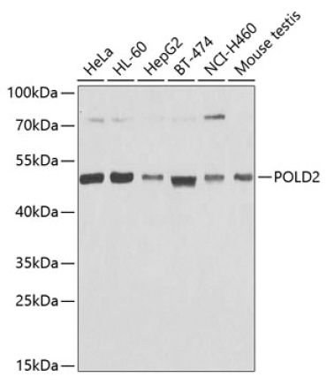 POLD2 Rabbit Polyclonal Antibody