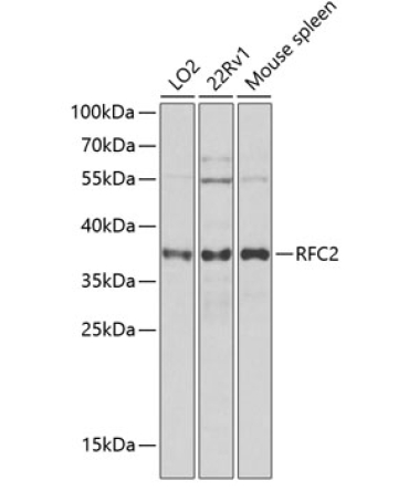 RFC2 Rabbit Polyclonal Antibody