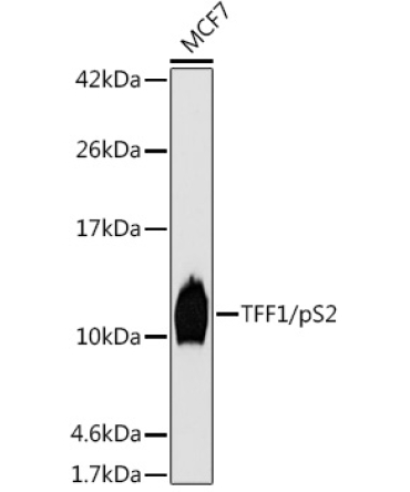 TFF1/pS2 Rabbit Monoclonal Antibody