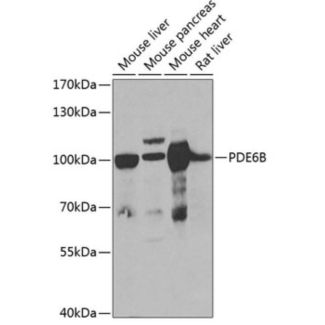 PDE6B Rabbit Polyclonal Antibody