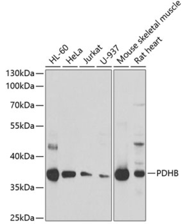 PDHB Rabbit Polyclonal Antibody