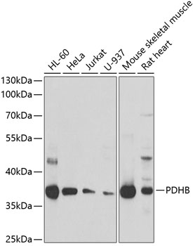 PDHB Rabbit Polyclonal Antibody