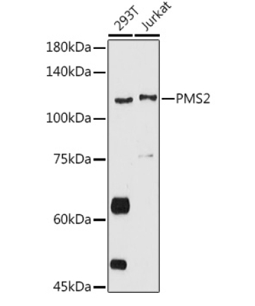 PMS2 Rabbit Polyclonal Antibody
