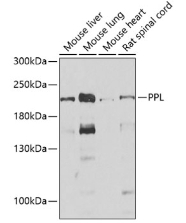 PPL Rabbit Polyclonal Antibody