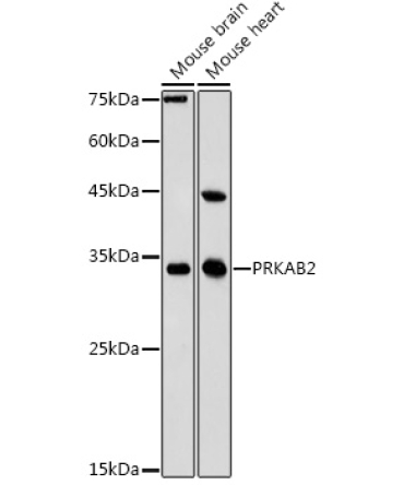 PRKAB2 Rabbit Polyclonal Antibody