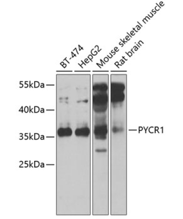 PYCR1 Rabbit Polyclonal Antibody