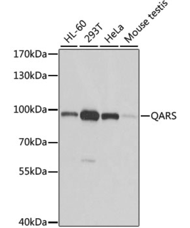 QARS Rabbit Polyclonal Antibody