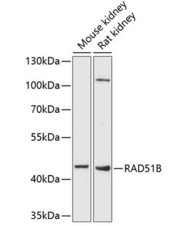 RAD51B Rabbit Polyclonal Antibody