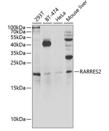 RARRES2 Rabbit Polyclonal Antibody