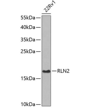 RLN2 Rabbit Polyclonal Antibody