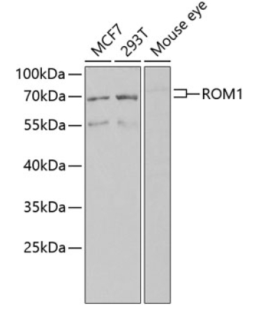 ROM1 Rabbit Polyclonal Antibody