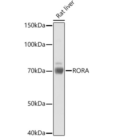 RORA Rabbit Polyclonal Antibody