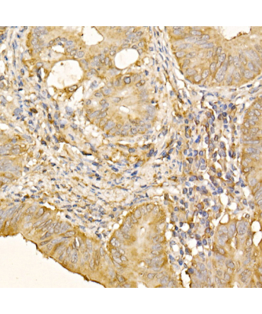 RPLP2 Rabbit Polyclonal Antibody