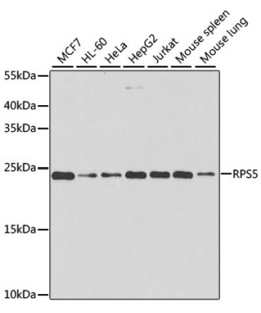 RPS5 Rabbit Polyclonal Antibody