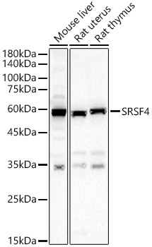 SRSF4 Rabbit Polyclonal Antibody