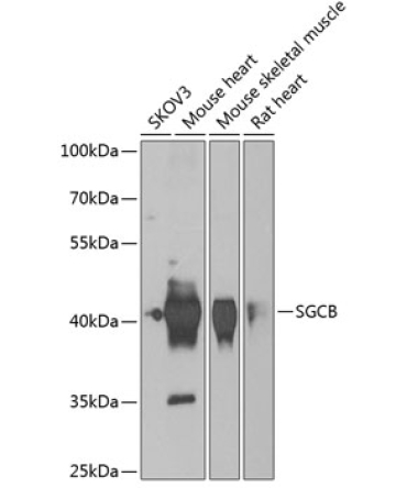 SGCB Rabbit Polyclonal Antibody