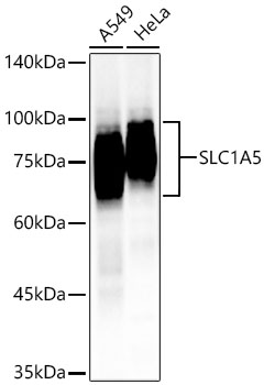 SLC1A5 Rabbit Polyclonal Antibody