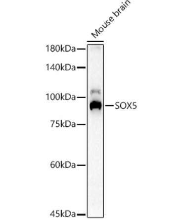 SOX5 Rabbit Polyclonal Antibody
