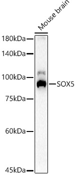 SOX5 Rabbit Polyclonal Antibody