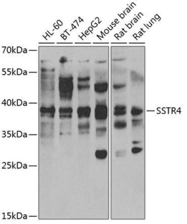 SSTR4 Rabbit Polyclonal Antibody