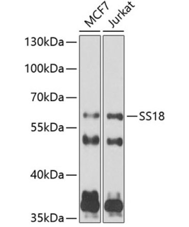 SS18 Rabbit Polyclonal Antibody