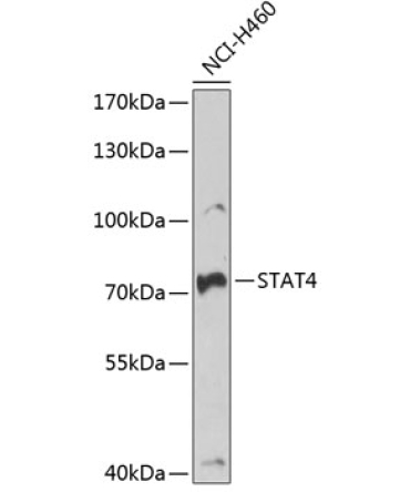 STAT4 Rabbit Polyclonal Antibody