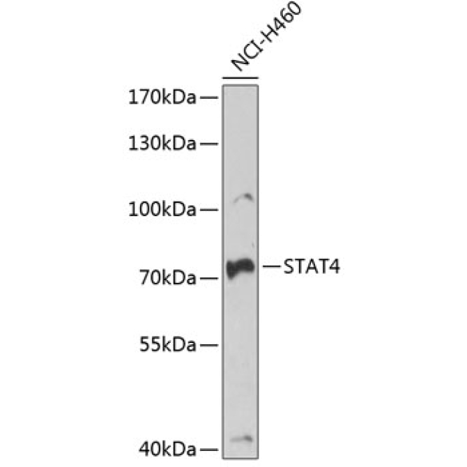 STAT4 Rabbit Polyclonal Antibody