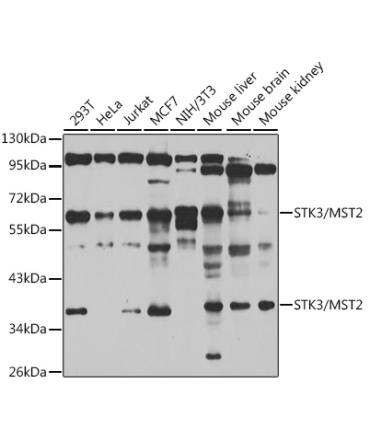 STK3/MST2 Rabbit Polyclonal Antibody
